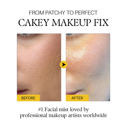 d'alba Piedmont Italian White Truffle First Spray Serum, Vegan Skin Care, Hydrating Face Moisturizer, Glow Serum for Radiant Skin, Non Comedogenic, All In One Mist, Korean skincare, 50ml 🍁 All In One Marketplace Canada