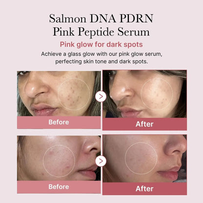 Medicube PDRN Pink One Day Serum Set 1.5mlx10